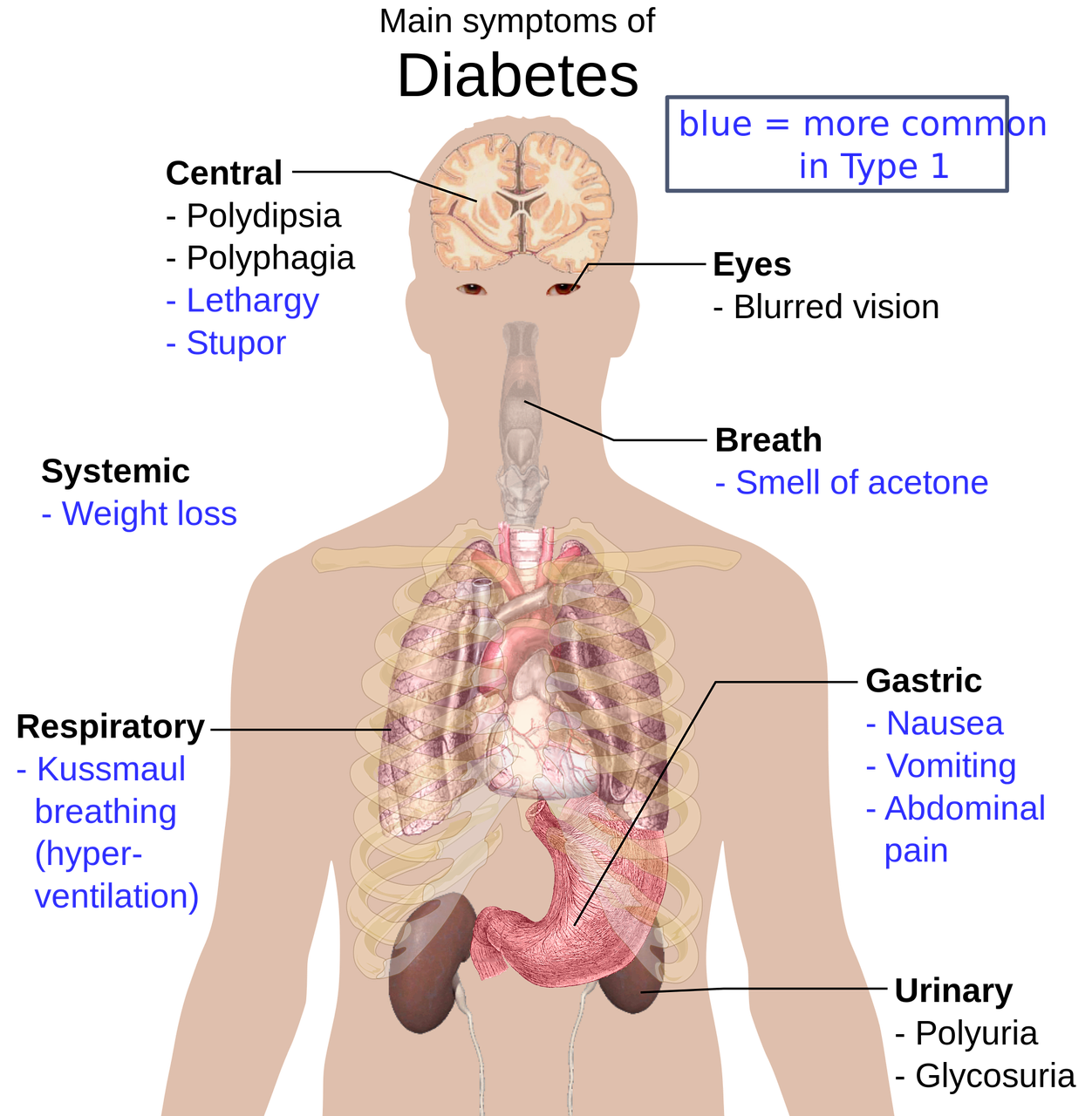 Diabetes symptoms